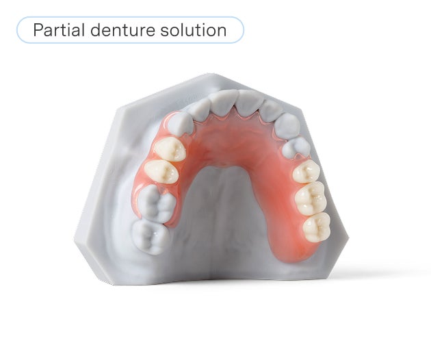A model of a partial denture solution showing the upper jaw with several artificial teeth attached to a pink gum-like base.