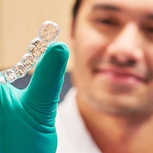 Close-up of a clear aligner held by a provider, showing the design used for teeth straightening with Motto