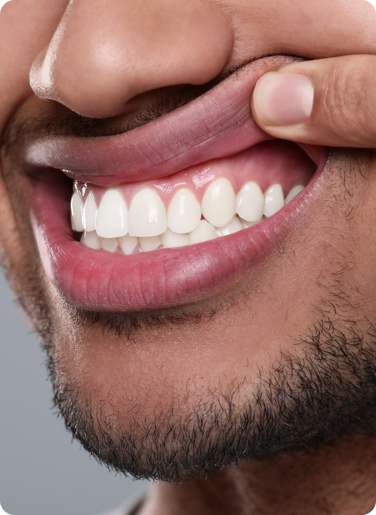 What do healthy gums look like?