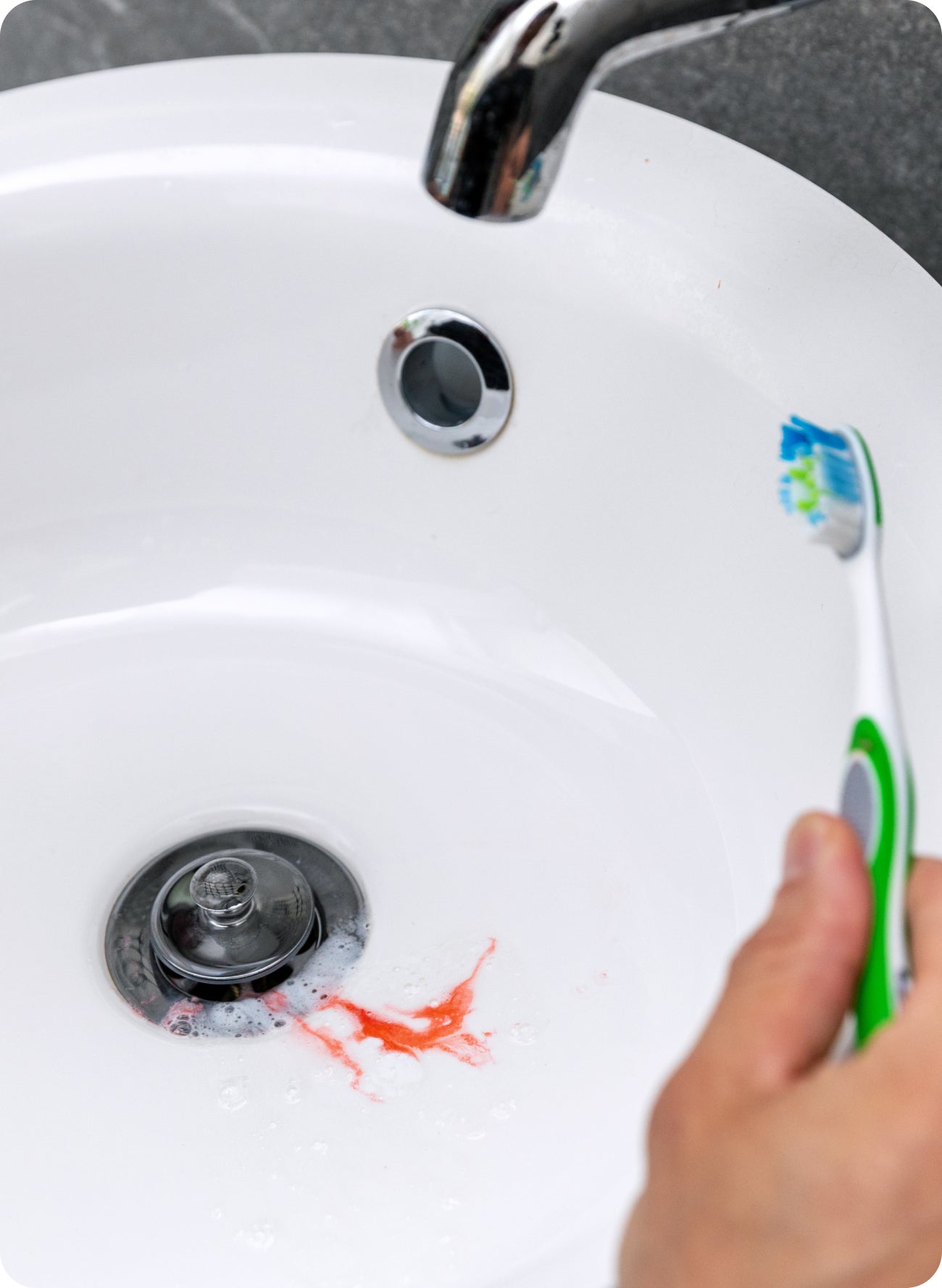 Why do my gums bleed every time I brush?