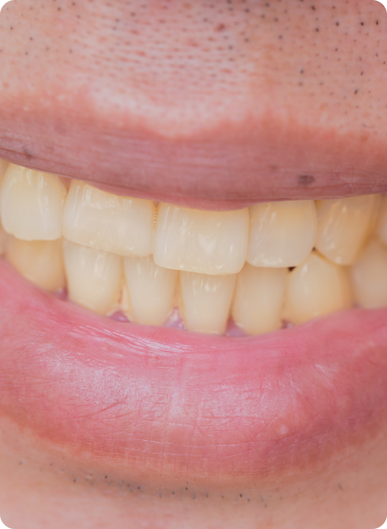 Why your teeth look yellow and what you can do about it