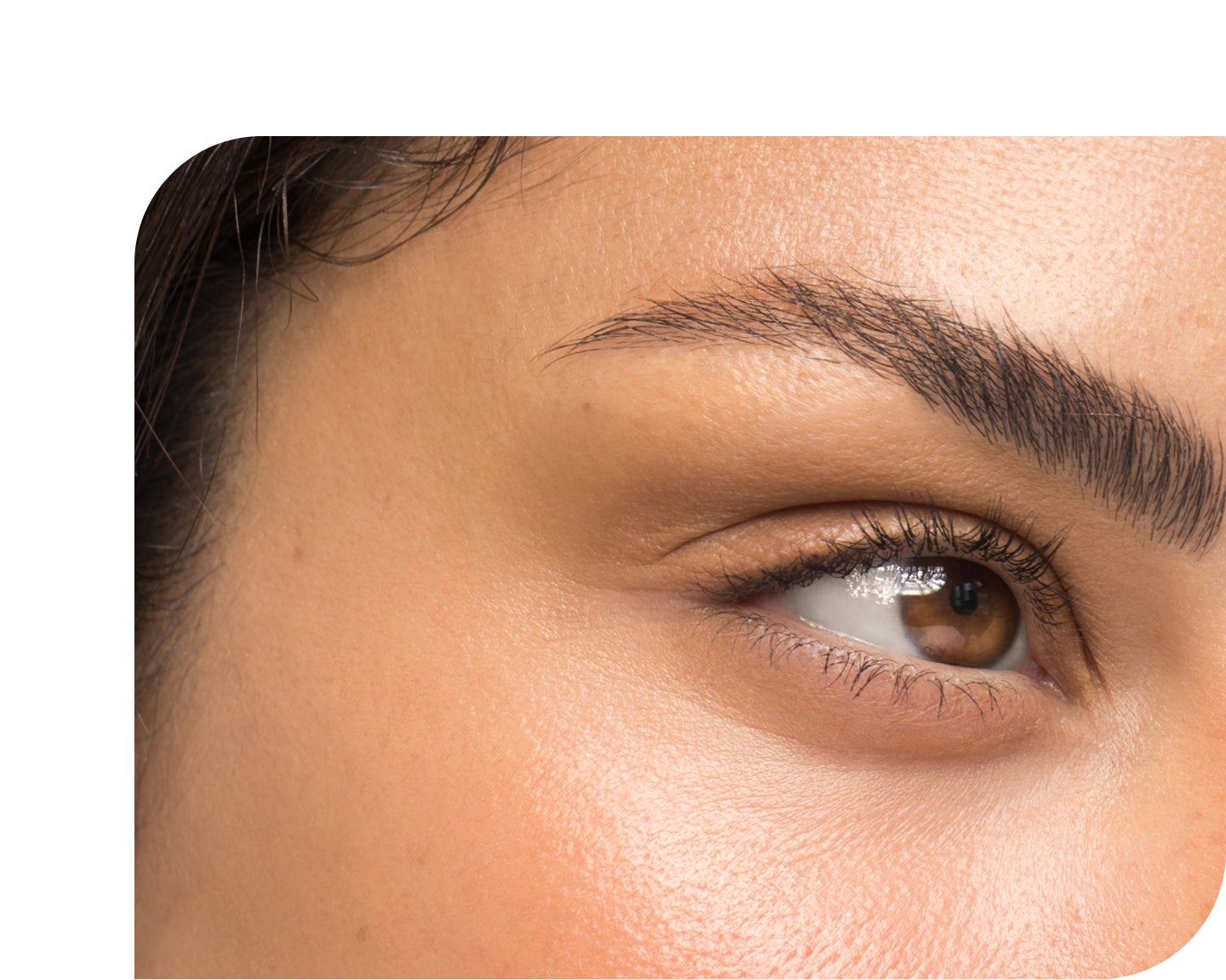 Close-up of facial injectable treatment performed to enhance natural features