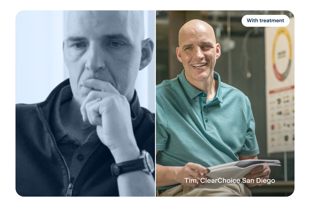 Before and after dental implants comparison of Tim, ClearChoice San Diego patient, showing him thoughtful before treatment and smiling after treatment with text reading “With treatment” and “Tim, ClearChoice San Diego.”