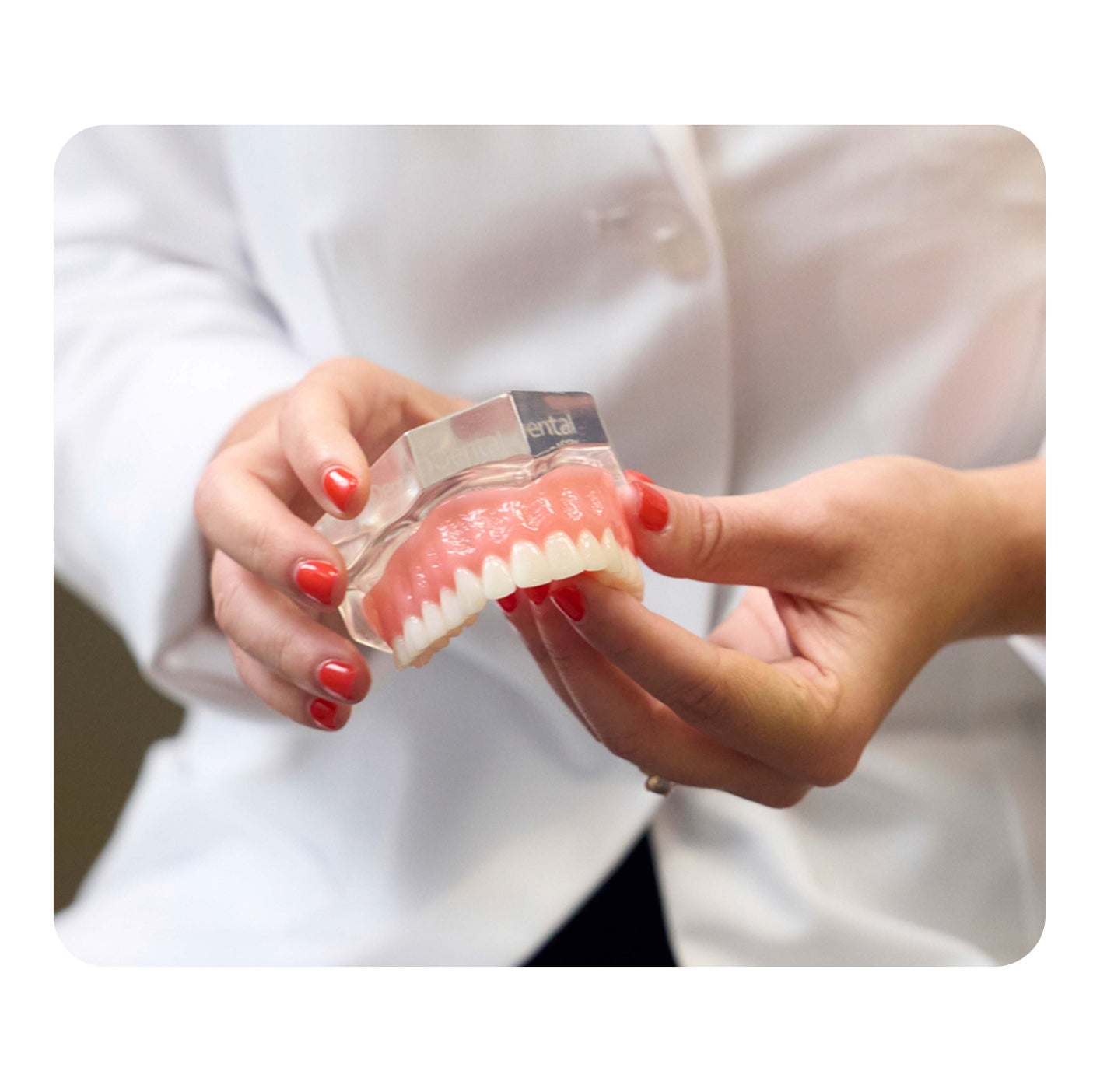 A dental professional in a white lab coat holding a dental model with artificial teeth and gums for demonstration purposes