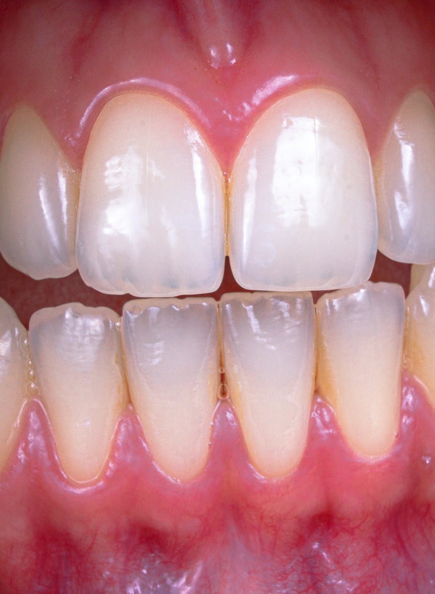 Healthy gums vs. inflamed gums: How to protect your smile