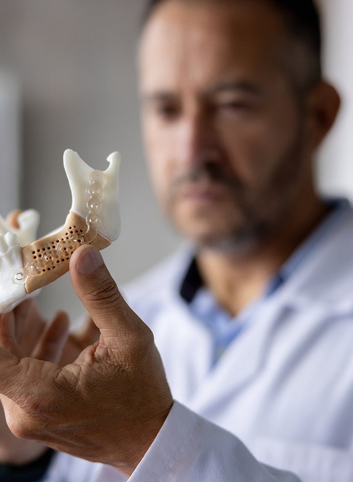 How much does a dental bone graft cost?