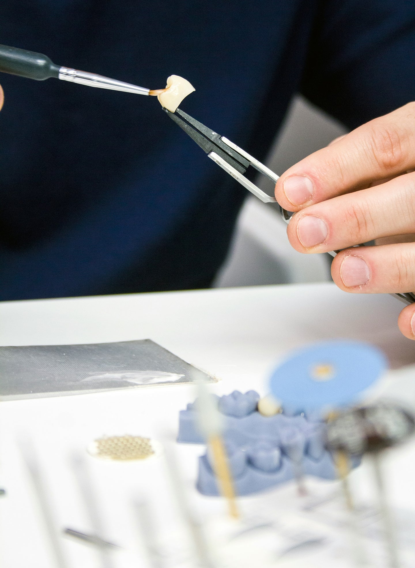 Dental implant crowns: what they are, how they work, and what to expect