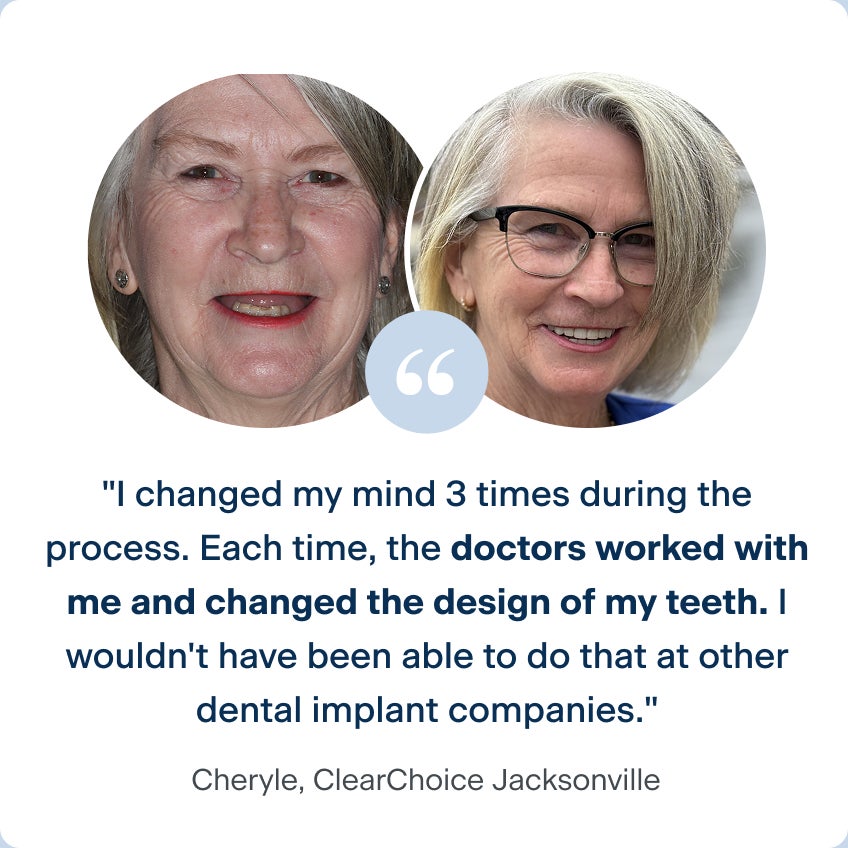 Before and after photos of Cheryle, a patient from the ClearChoice Jacksonville center, with her quote describing her experience with ClearChoice: I changed my mind 3 times during the process. Each time, the doctors worked with me and changed the design of my teeth. I wouldn't have been able to do that at other dental implant companies.