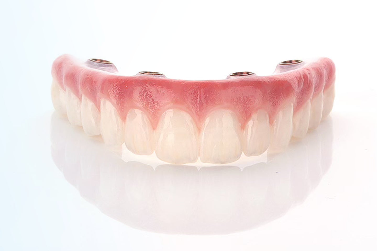 A full-arch dental implant prosthesis shown from the front, featuring natural-looking teeth and implant connection points.