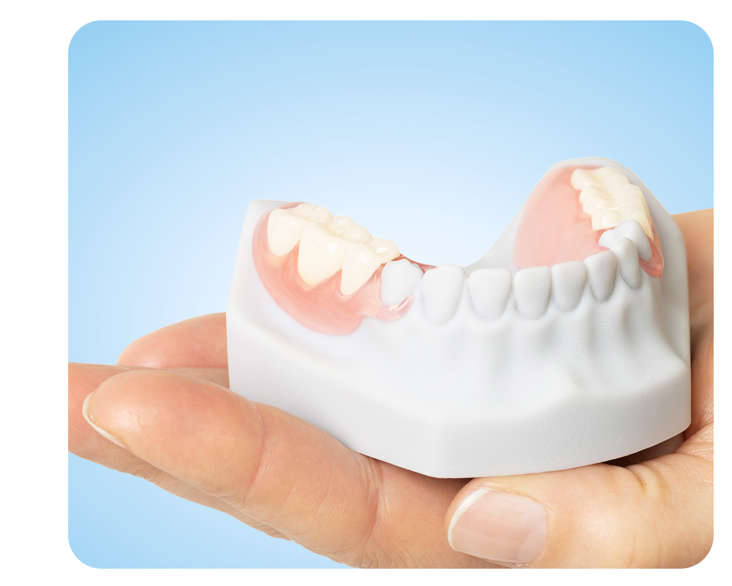 A close-up shot of a partial denture model being held in the palm of a hand. The model is a realistic representation of a denture with a pink, gum-like base and several white teeth.