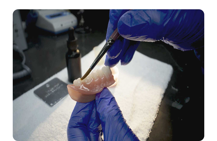 Gloved hands apply material to the underside of a denture using a brush, illustrating precise lab work involved in a professional denture reline at Aspen Dental.