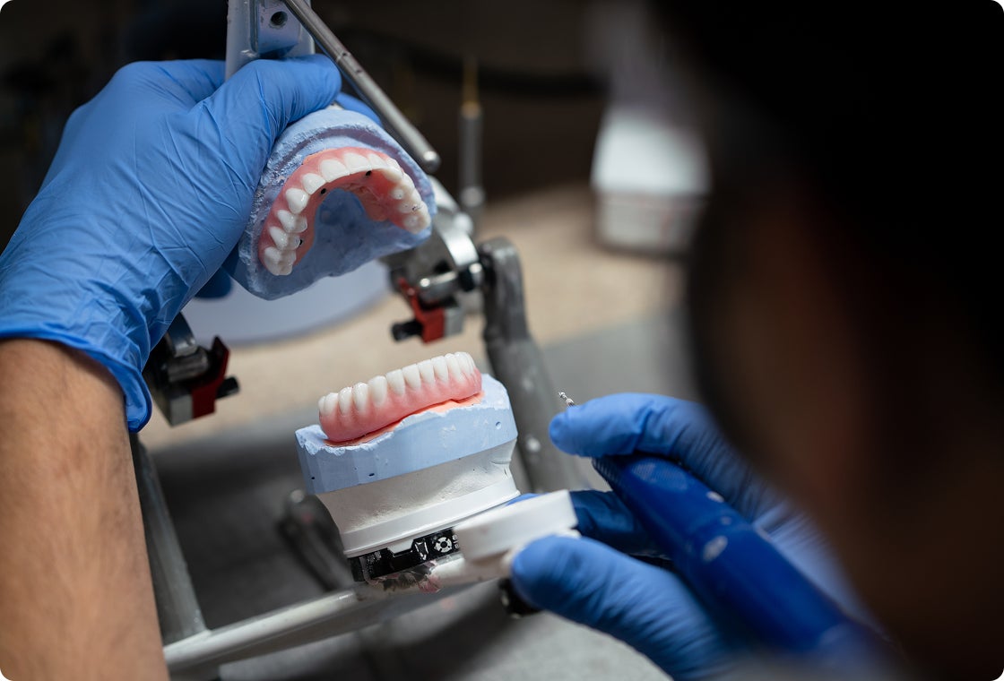 A ClearChoice lab technician wearing blue gloves is examining a pair of dental implant upper and lower arch model, ensuring he is crafting long-lasting dental implants that best fit the patient.