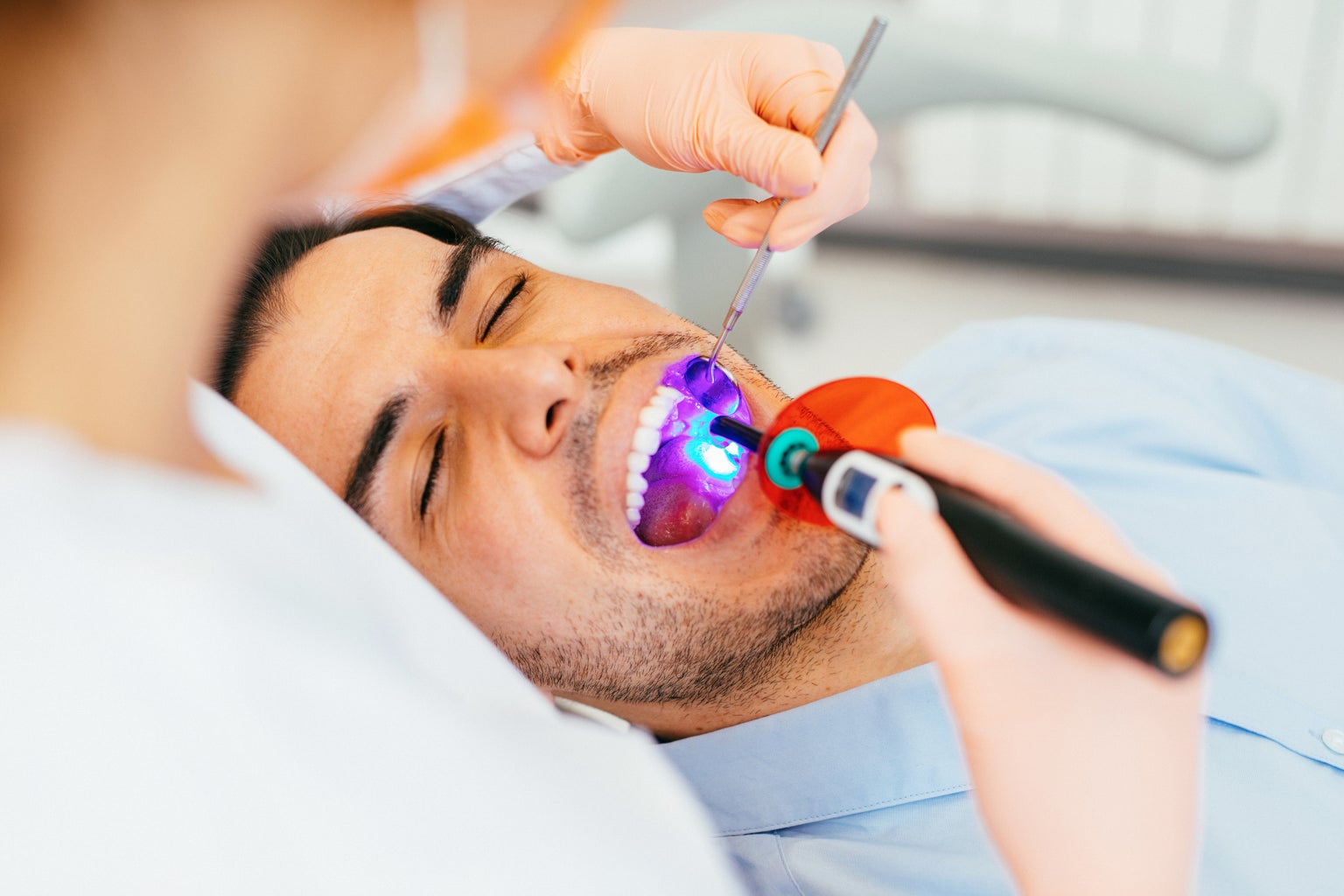 Cavity: Causes, Symptoms, Prevention, and Treatment