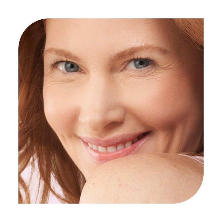 Microneedling treatment results in Fargo, North Dakota