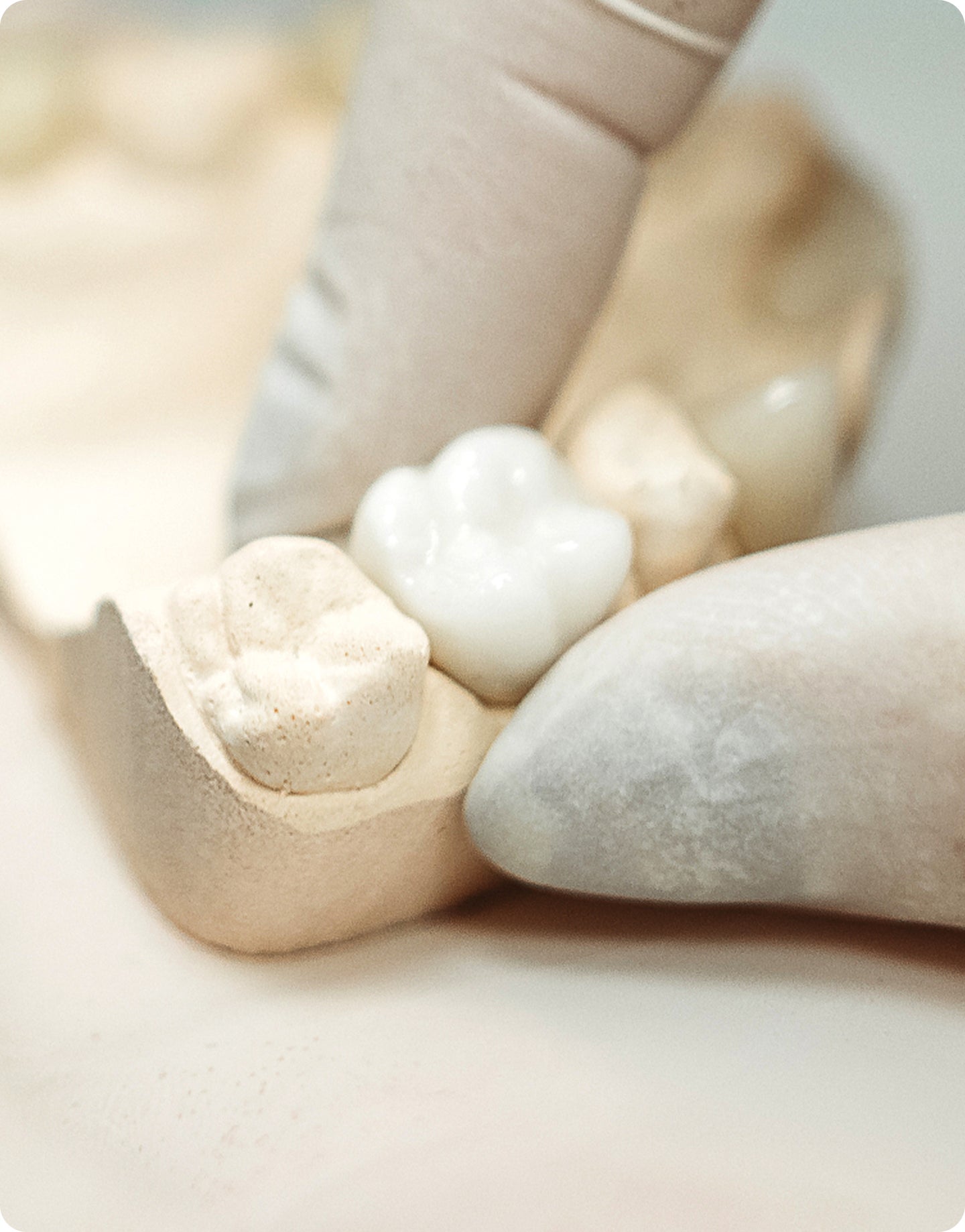 Close-up of a dental model showing different types of tooth crowns on a jaw replica.