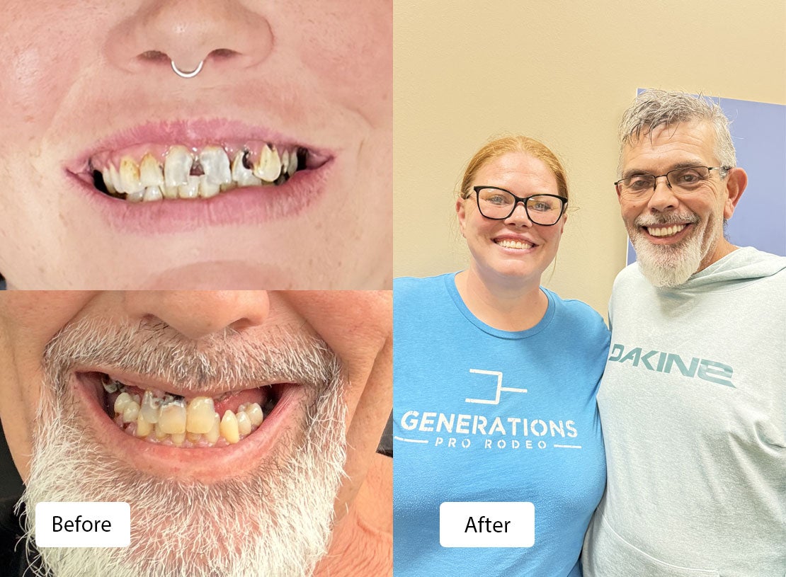 Before and after images illustrating a dental transformation to happy smiles