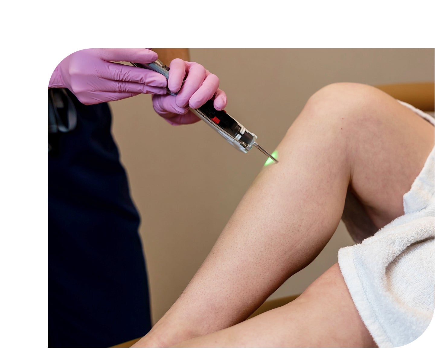 Laser hair removal on a leg