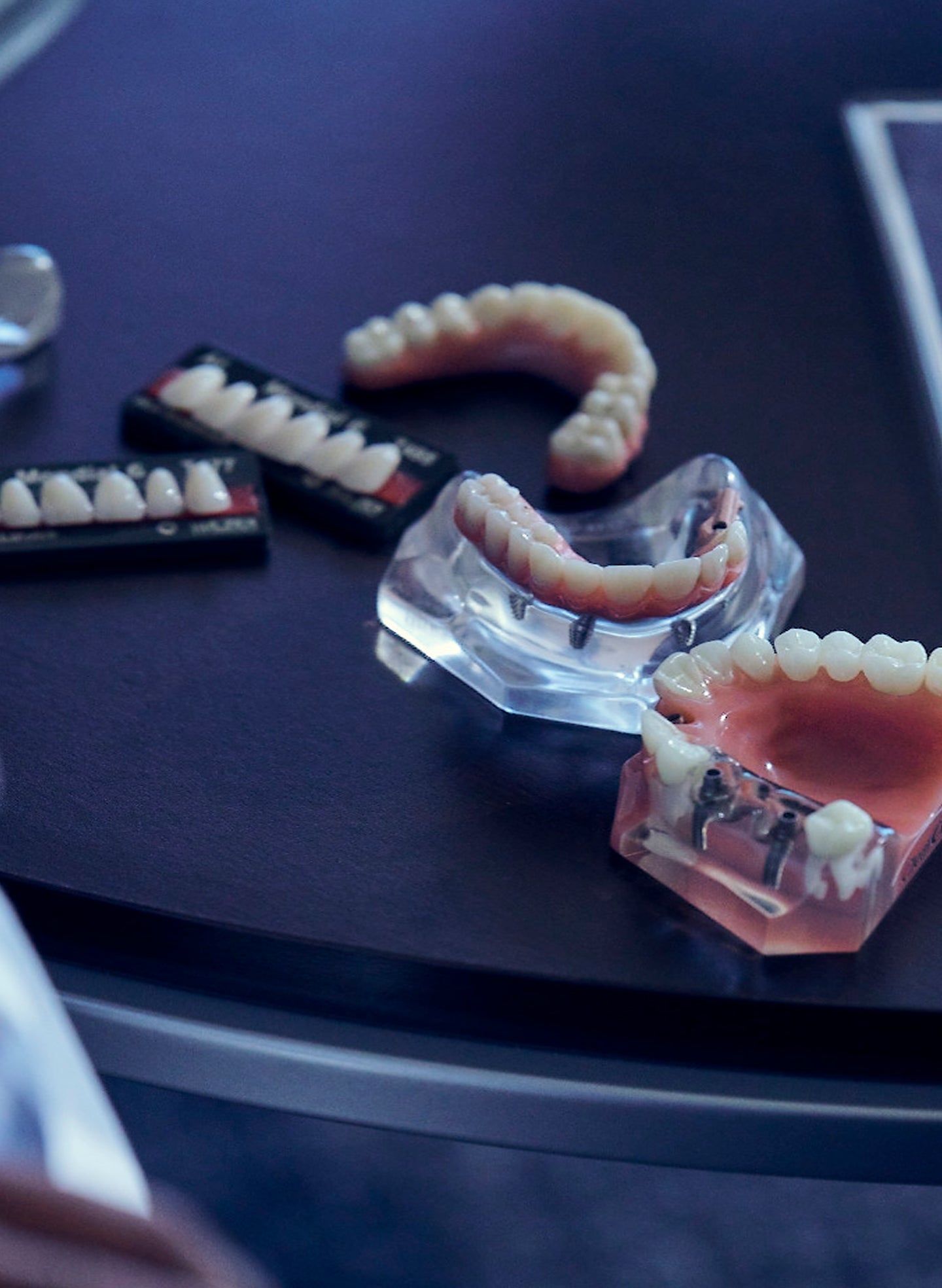 Dental implants cost: what affects price, what’s included, and how to compare quotes