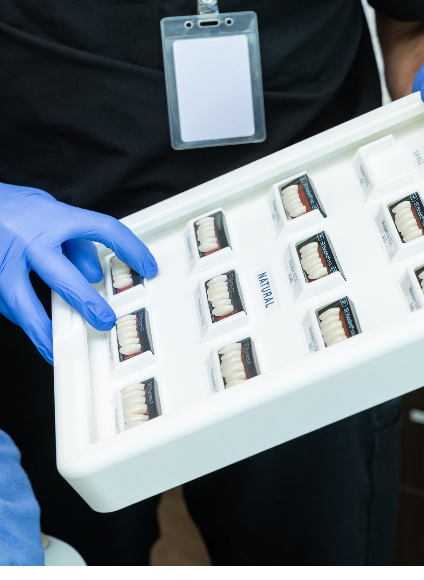 Zygomatic dental implants: what they are, who may be a candidate, and what to expect