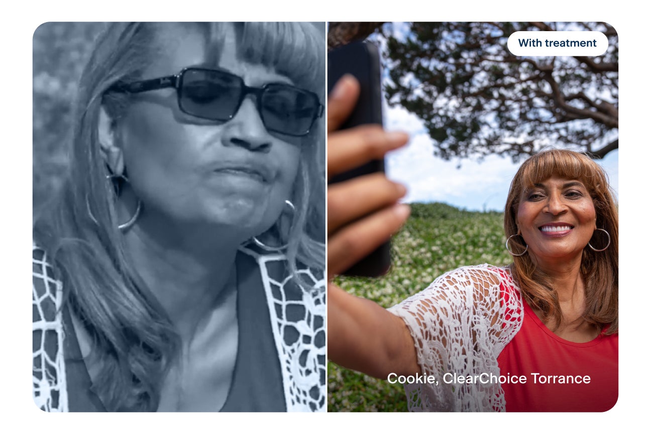 Before and after dental implants comparison of Cookie, ClearChoice Torrance patient, showing her serious before treatment and smiling while taking a selfie after treatment with text reading “With treatment” and “Cookie, ClearChoice Torrance.”