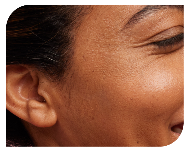 Close-up side profile of a person's ear and face, showing skin texture and a crinkled eye