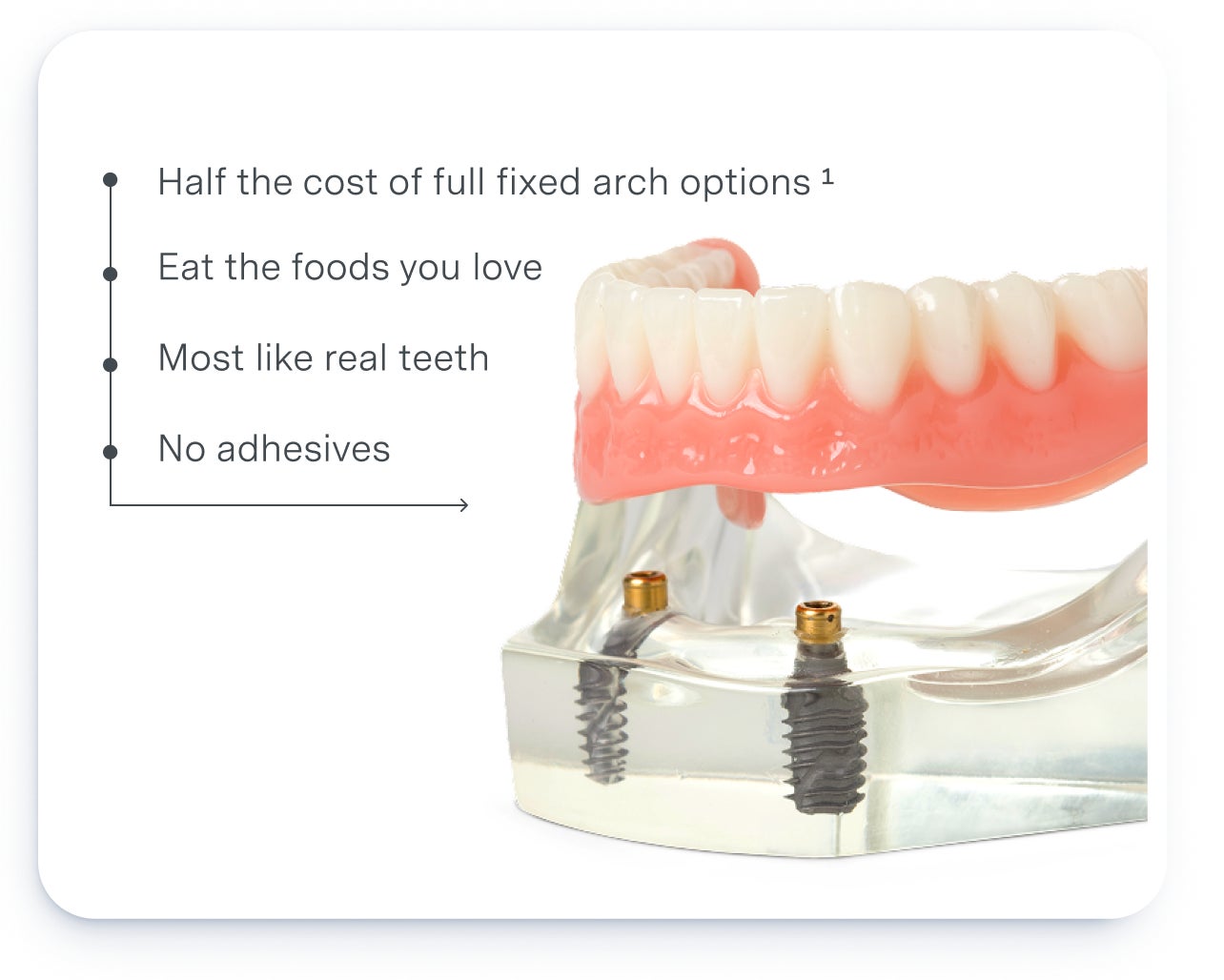 A transparent model showcases Aspen Dental’s implant-supported dentures secured by two implants, offering a natural and adhesive-free solution.