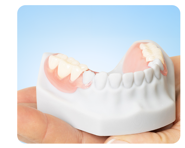A hand holds a white dental model showing a flexible, pink partial denture with a few white replacement teeth attached to the side.