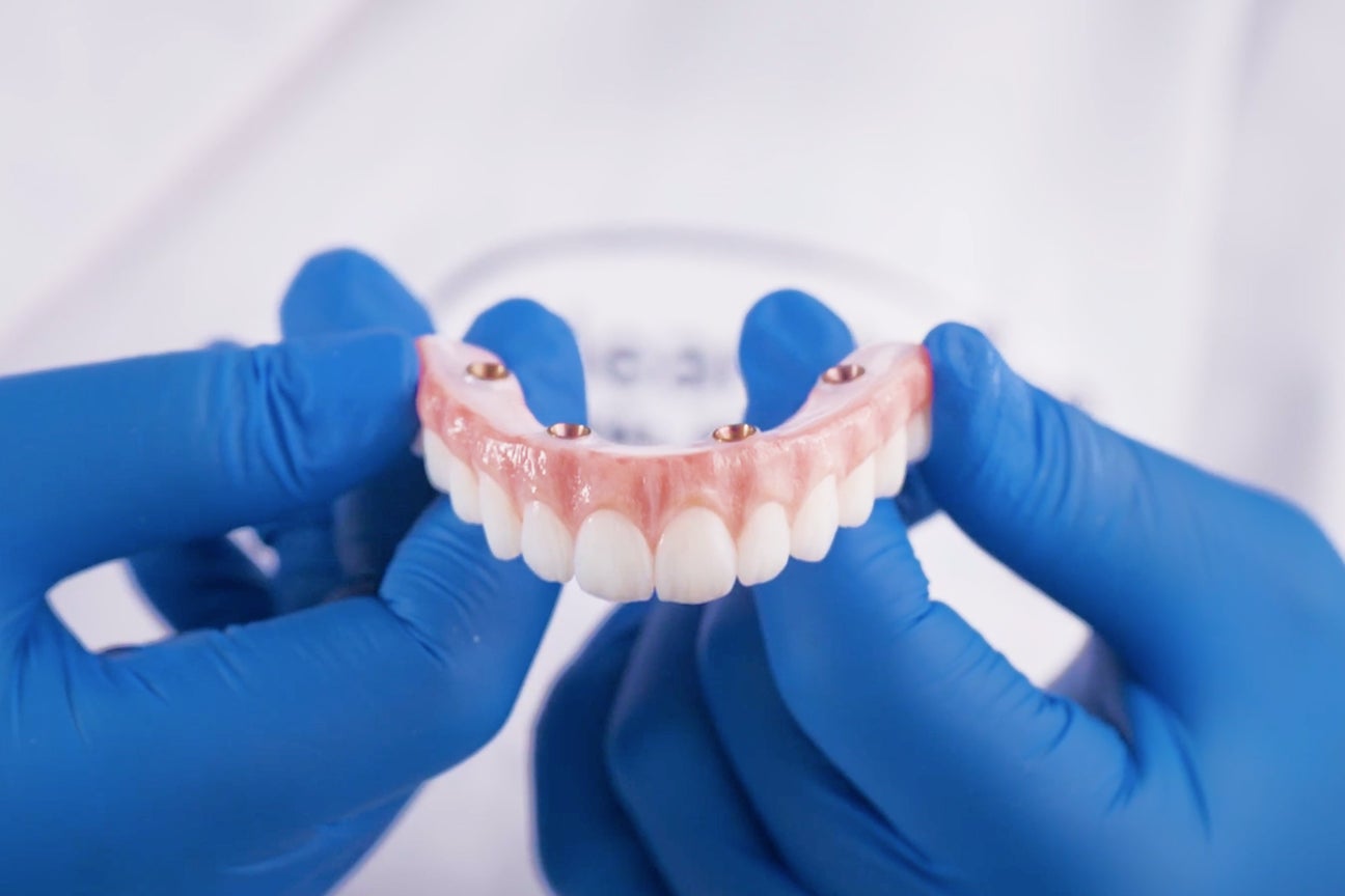 A ClearChoice professional holding an upper arch dental implant model with both hands, while explaining the benefits of coming to ClearChoice for full-arch dental implants.