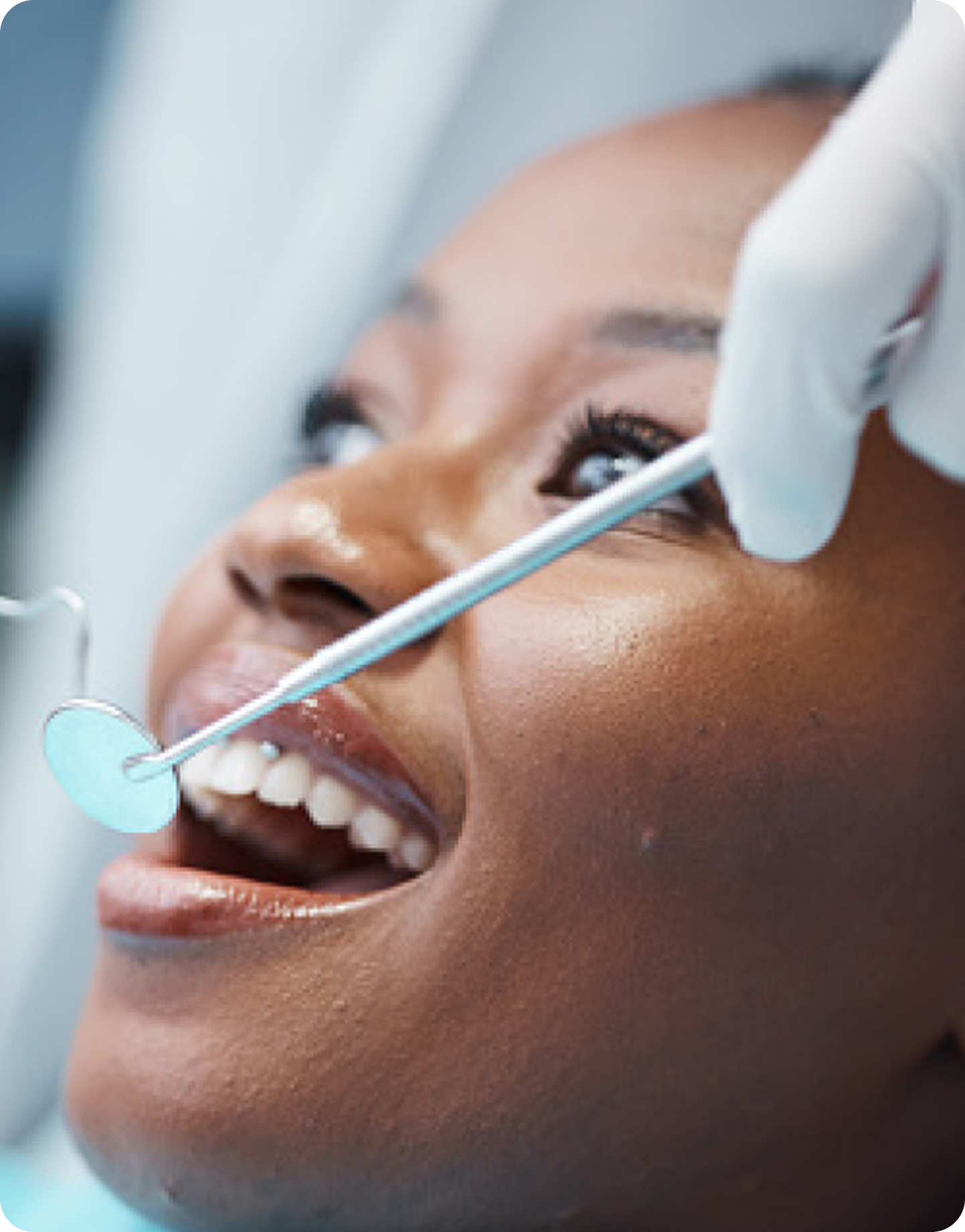 Dental Crowns vs Veneers at Aspen Dental: What South Orlando, FL Residents Should Know