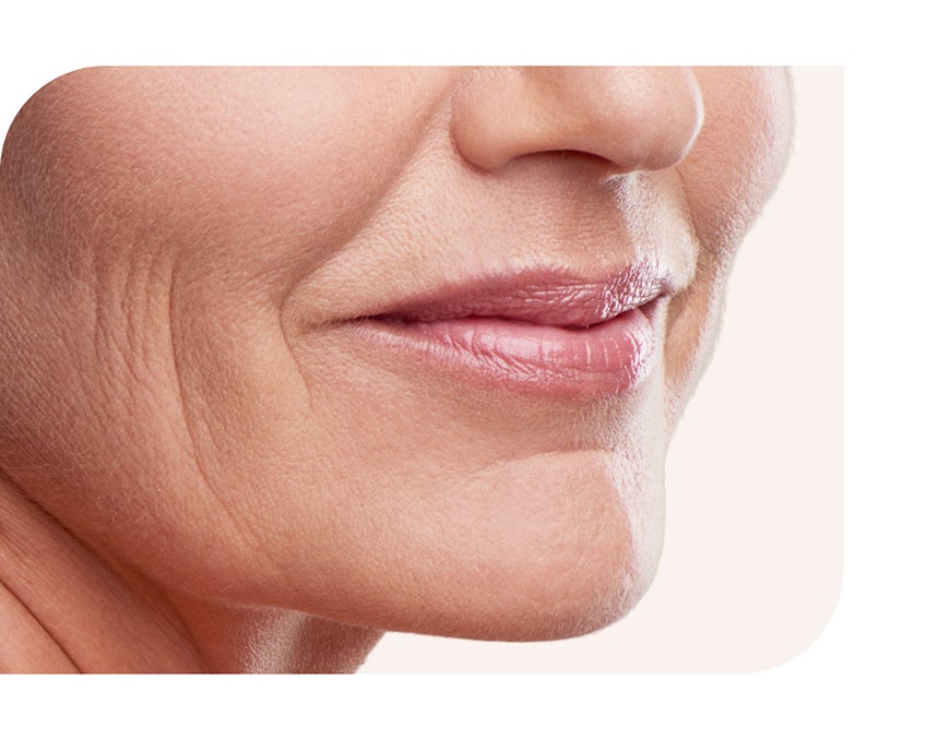 Close-up of the mouth and chin area with visible lines and wrinkles