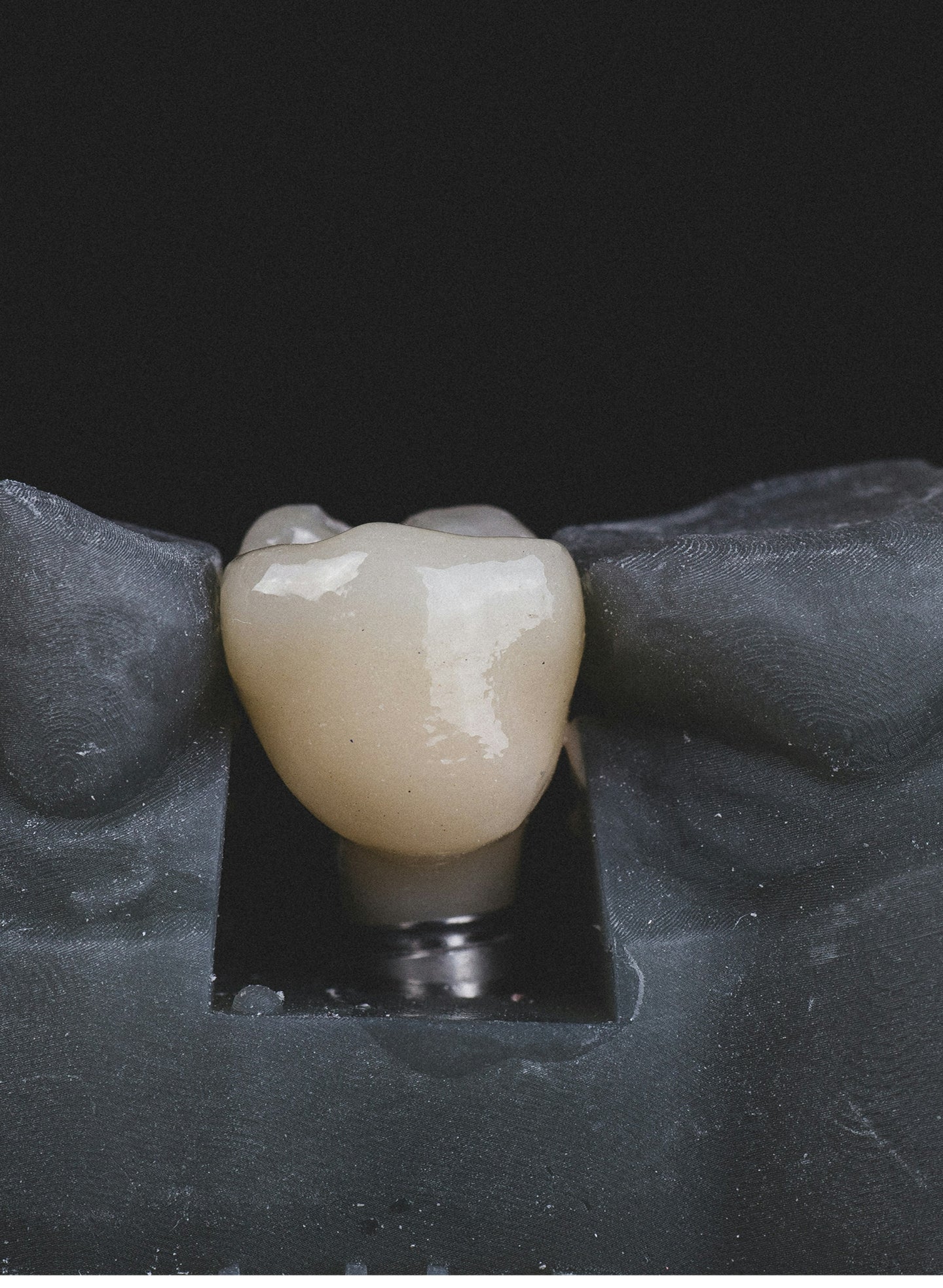 Dental implant crown fell out: what it means, immediate steps, and how it is fixed 