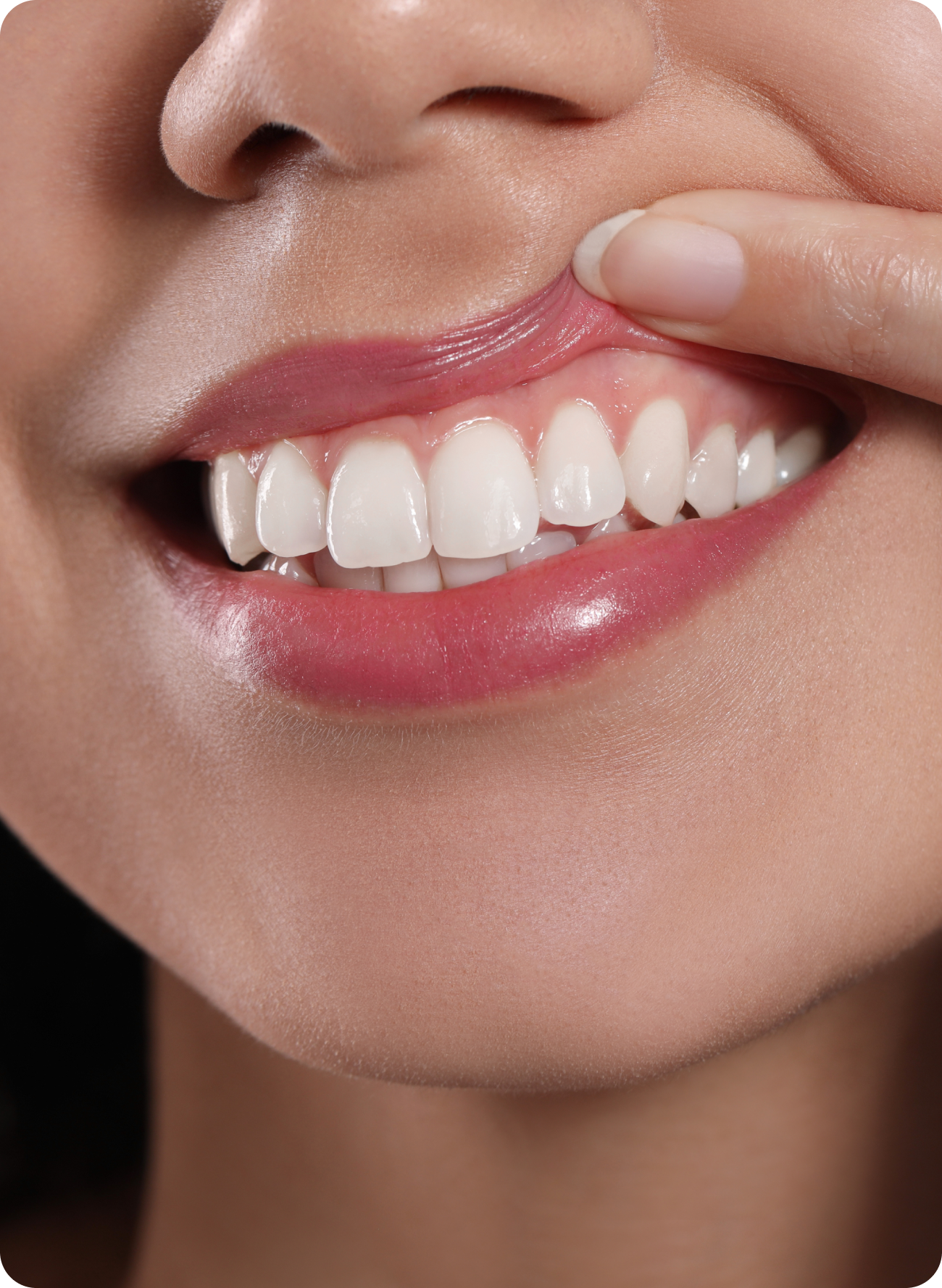 Why is there a loose gum flap behind my back tooth?