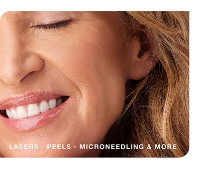 Close-up of a smiling woman's face with text promoting lasers, peels, and miconeeding.