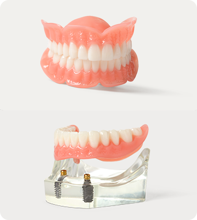 Understanding Your Dental Implant Options: Aspen Dental in East Orlando, FL