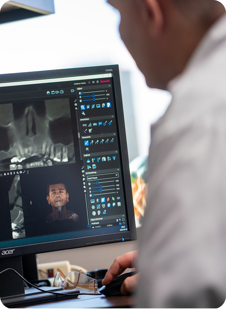 How 3D imaging improves dental implant placement