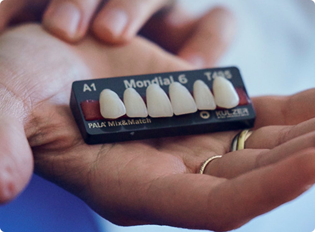 A prosthodontist displays a tooth shade guide in hand, emphasizing how ClearChoice custom dental implants are personalized for each patient's natural tooth color and shape.