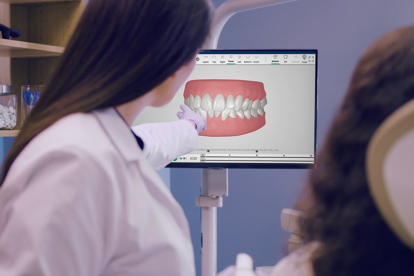 Provider reviewing a digital teeth alignment model on a screen, showing clear aligner treatment planning with Motto
