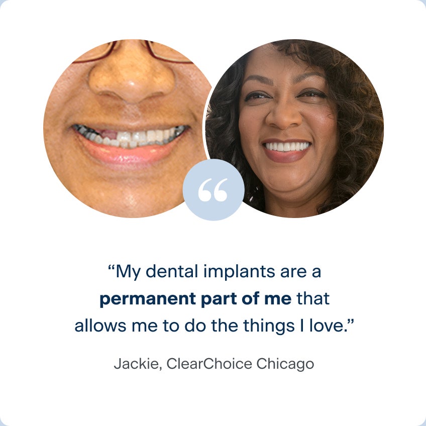 Before and after photos of Jackie, a patient from the ClearChoice Chicago center, with her new dental implants and her quote: My dental implants are a permanent part of me that allows me to do the things I love.