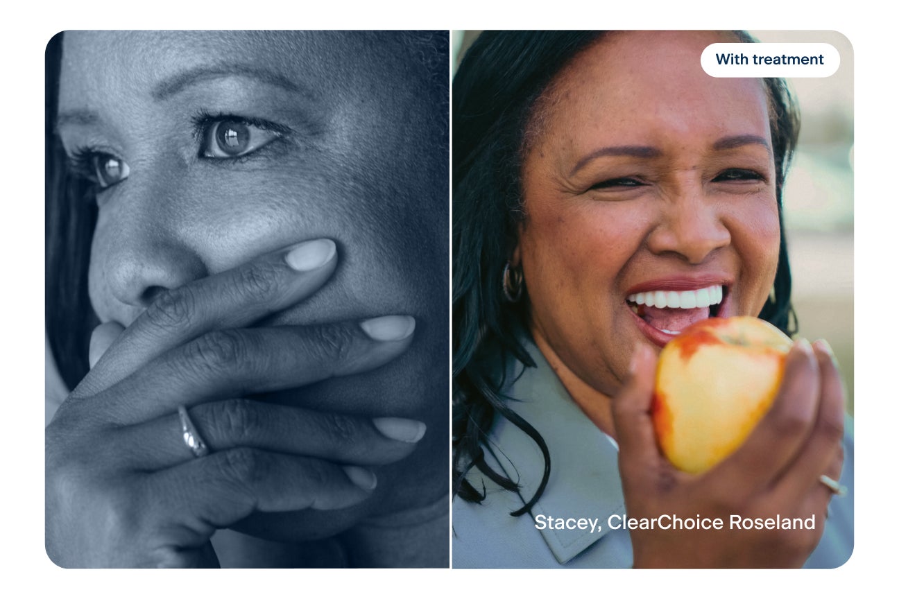 Before and after dental implants comparison showing Stacey, ClearChoice Roseland patient, covering her smile before treatment and smiling while eating an apple after treatment with text reading “With treatment” and “Stacey, ClearChoice Roseland.”