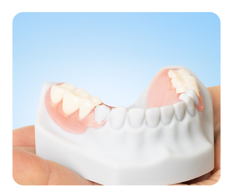 A hand holds a white dental model showing a flexible, pink partial denture with a few white replacement teeth attached to the side.