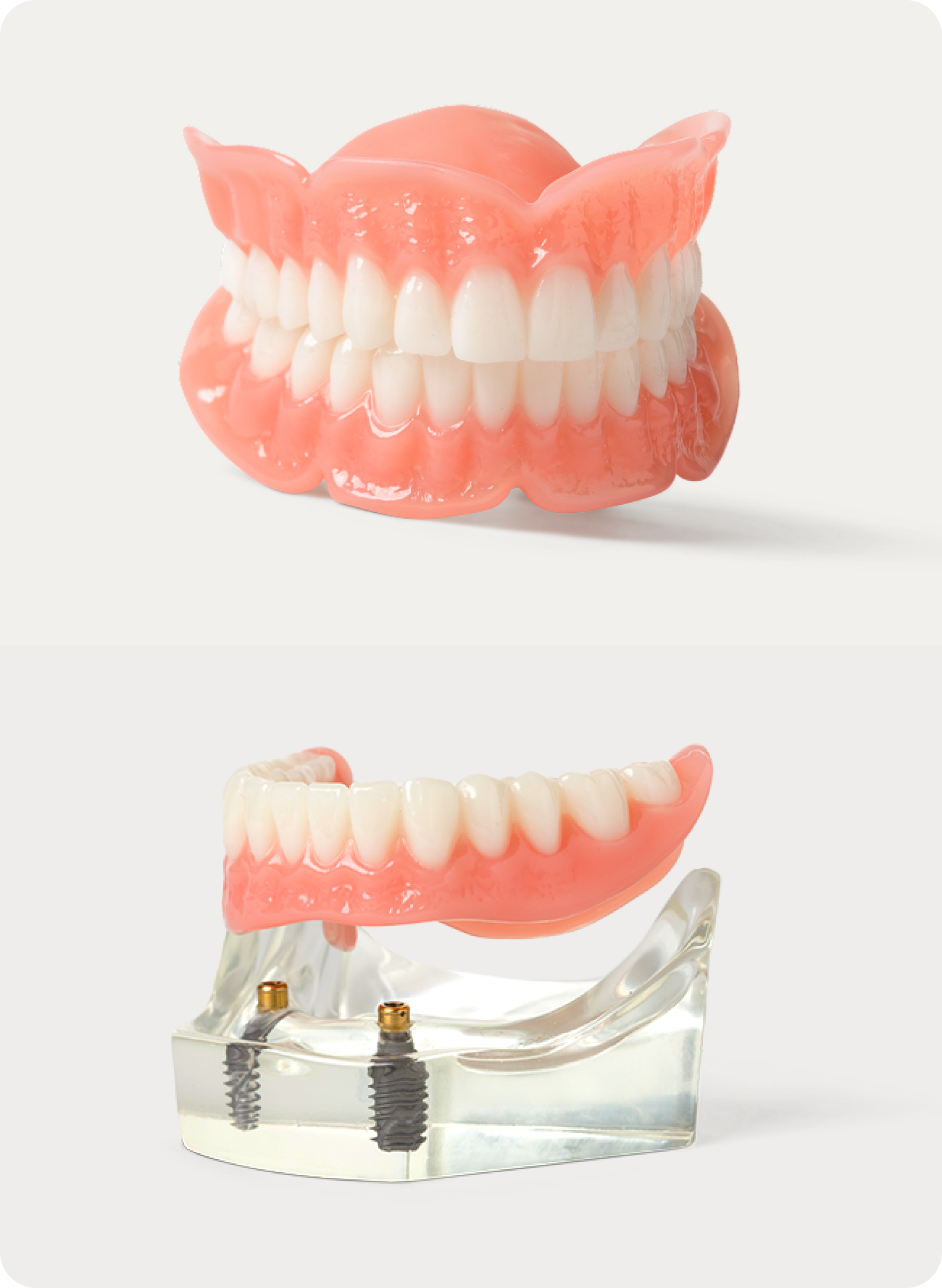 Dental Implant Solutions for Loose Dentures in Charlotte, NC