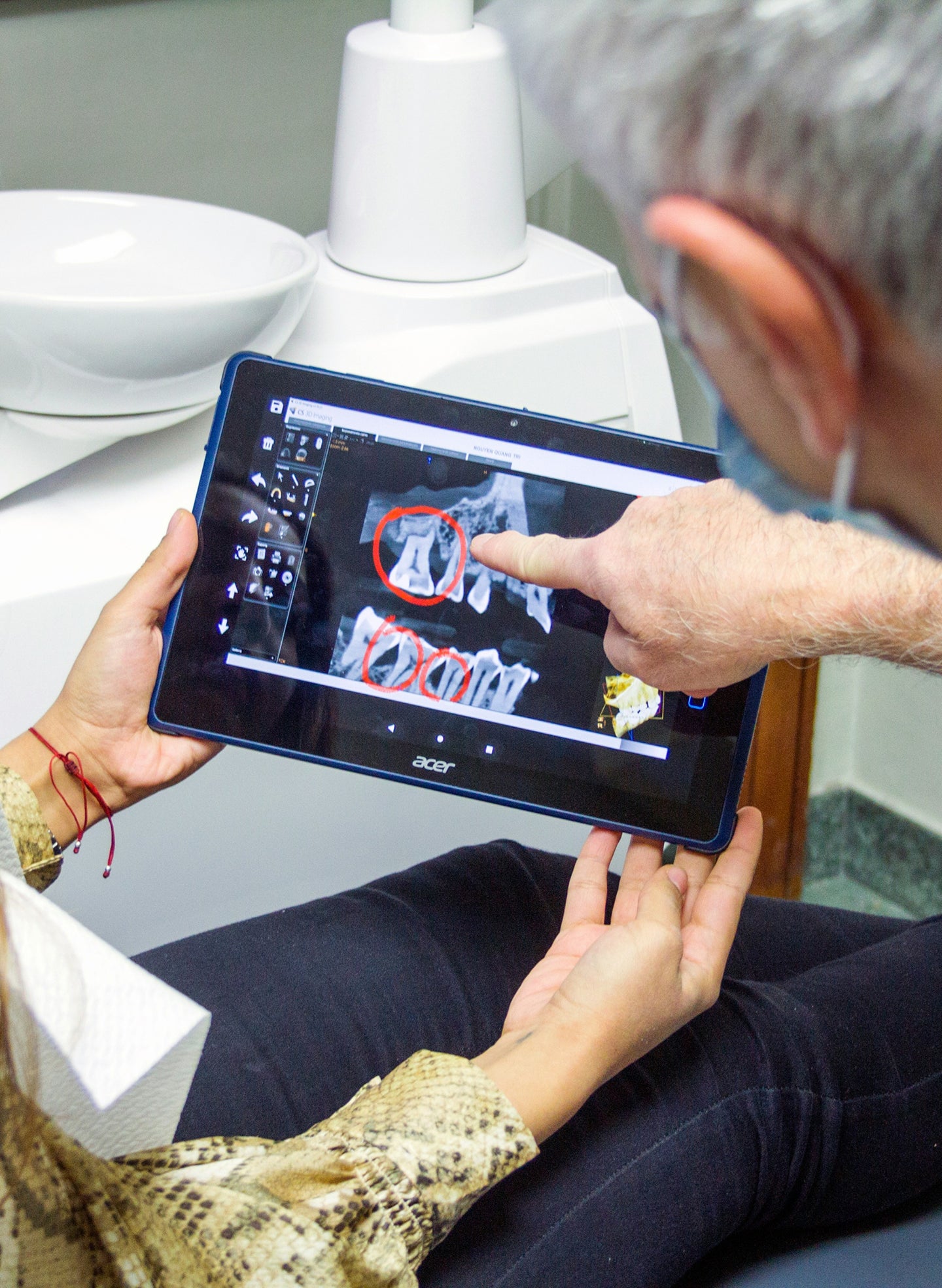 Evolution of human teeth: Why wisdom teeth exist and impact on implants