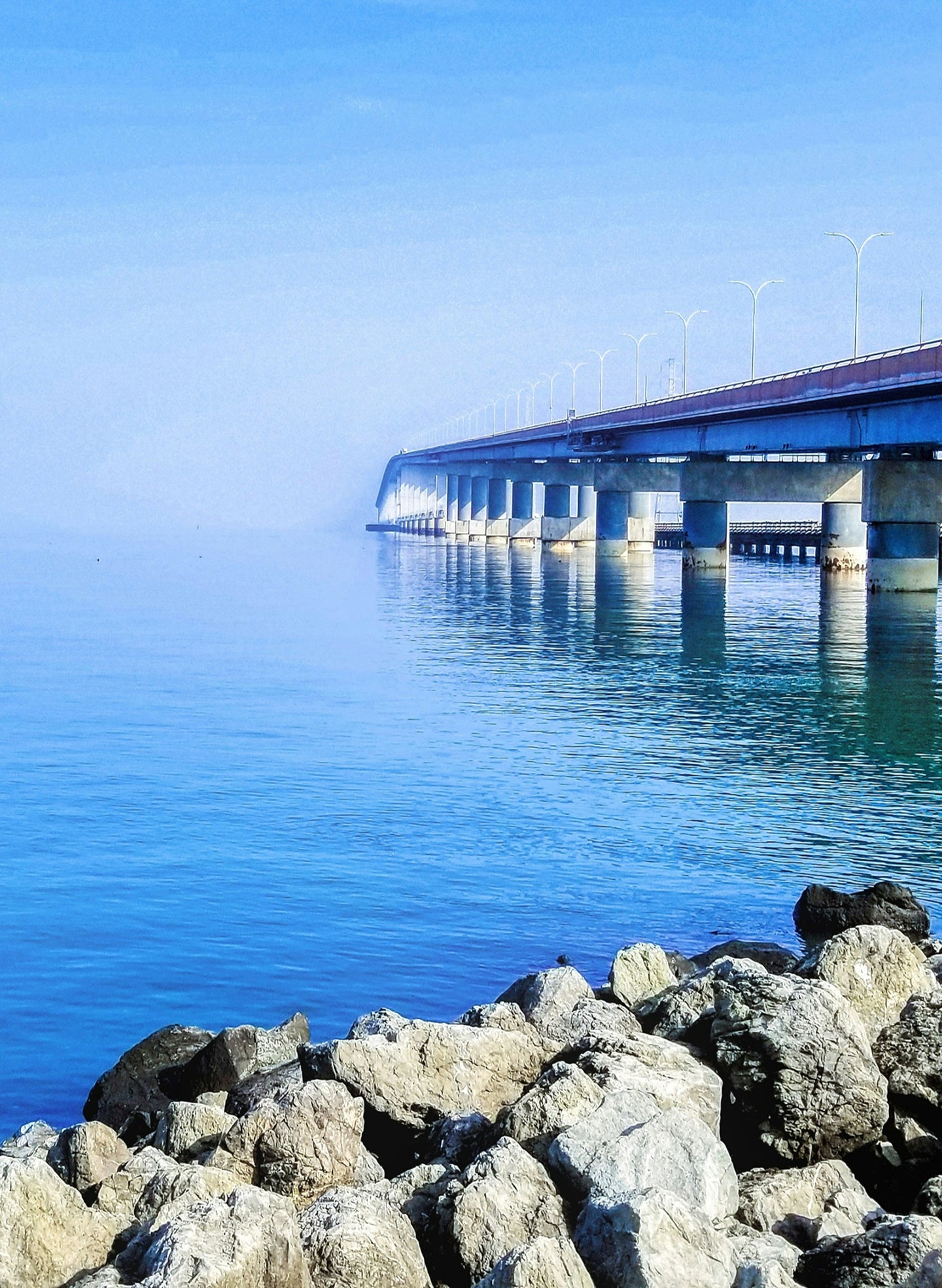 All-in-one dental implants in San Mateo: what the term means and what to ask