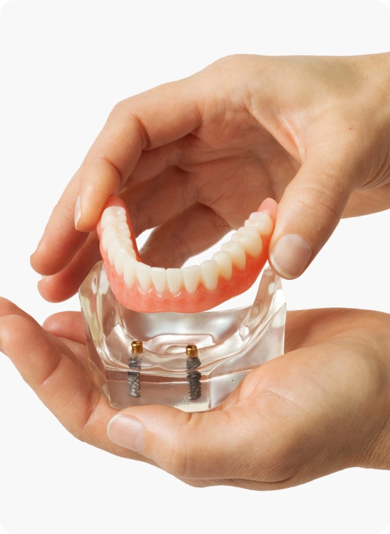 The myth of $399 dental implants