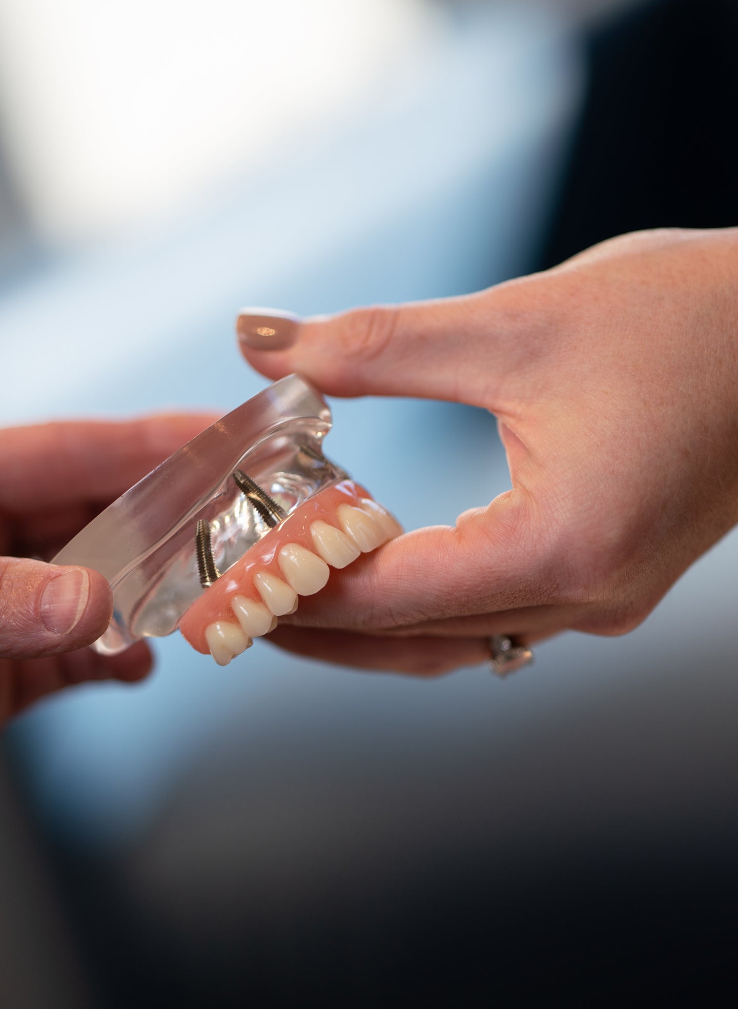 Why some patients need multiple temporary prostheses before final teeth