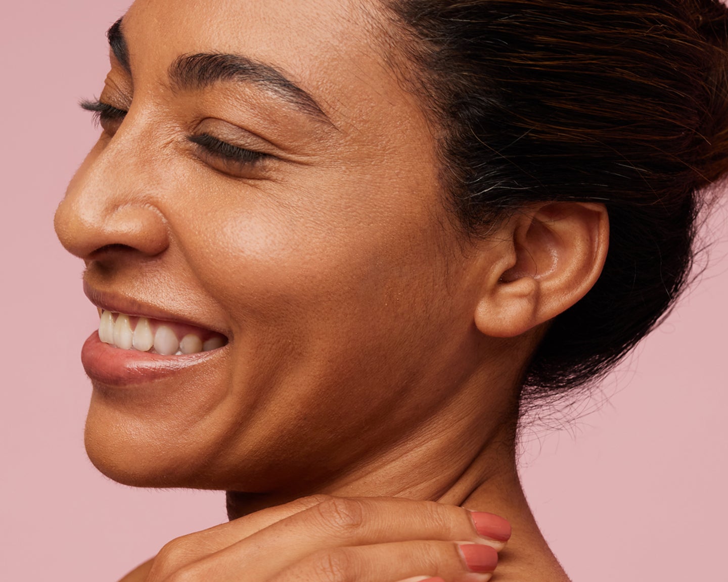 Woman smiling with radiant skin after a VI Peel chemical peel at Chapter Aesthetic Studio.