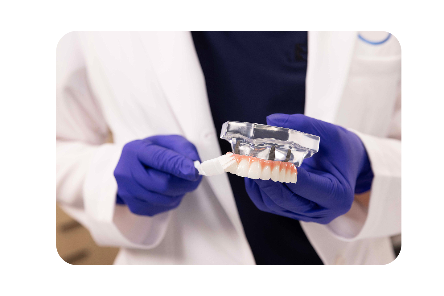 Aspen Dental provider presents proper cleaning tools and methods for maintaining dental implants and prosthetic restorations.