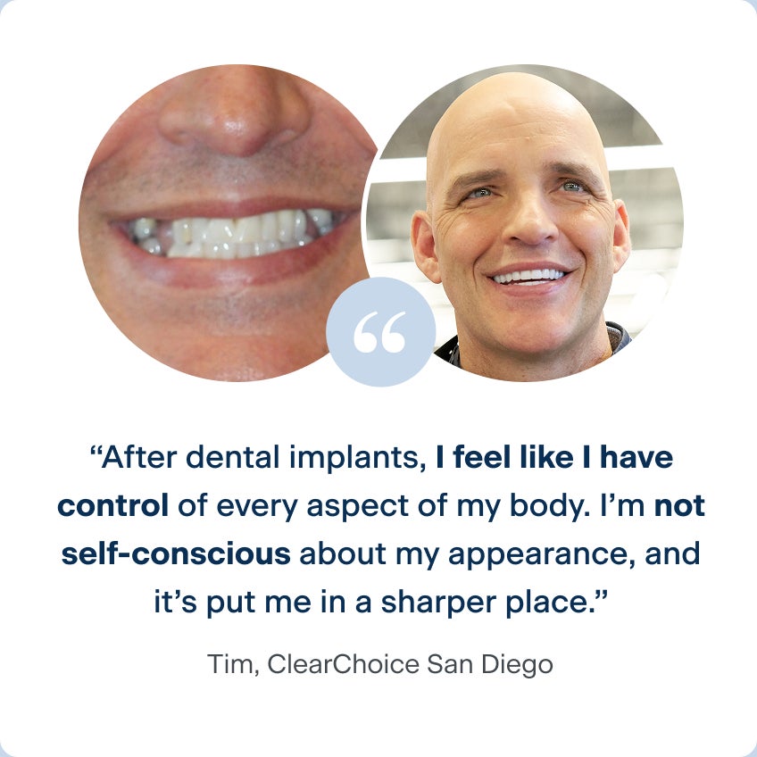 Before and after photos of Tim, a patient from the ClearChoice San Diego center, with his new dental implants and his quote describing life after implant treatment: After dental implants, I feel like I have control of every aspect of my body. I'm not self-conscious about my appearance, and it's put me in a sharper place.