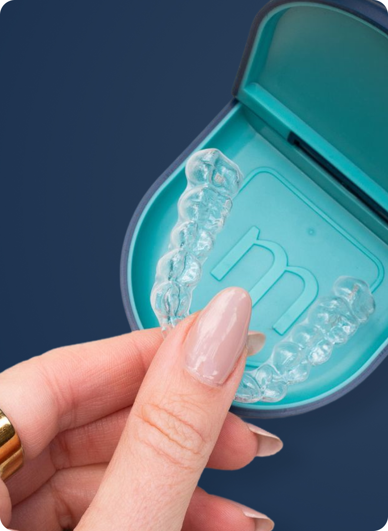 How Much Do Clear Aligners Cost? 2026 Guide