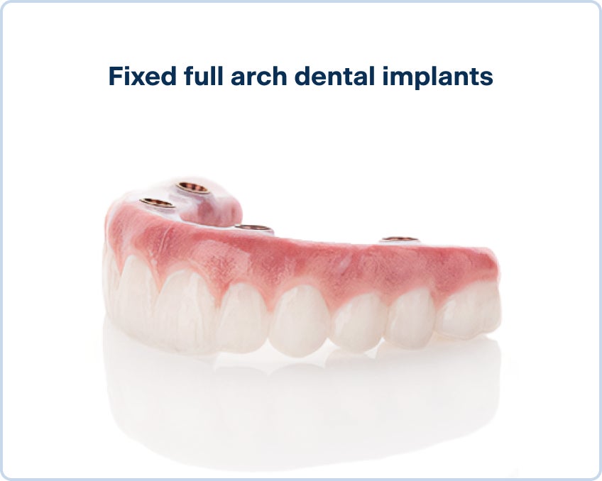 An image of an upper fixed full arch dental implant, made by premium zirconia for high-quality and long-lasting results.